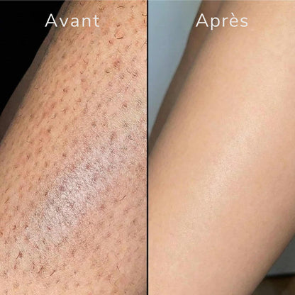Le soin anti-repousse naturel — Nala™